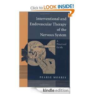 Interventional and Endovascular Therapy of the Nervous System: Pearse 