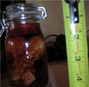 CONJOINED FETUS TWINS IN A JAR,MEDICAL,MONSTER,FETAL HORROR,SIDESHOW 